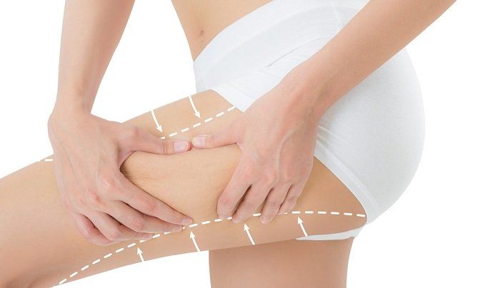 Thigh Contouring image